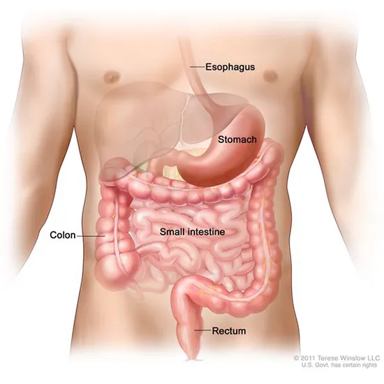 Gastrointestinal Stromal Tumor (GIST)